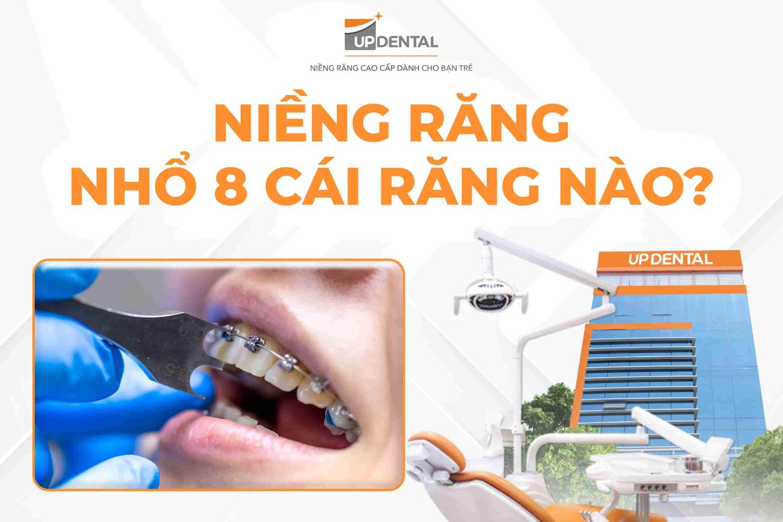 Niềng răng nhổ 8 cái răng nào?