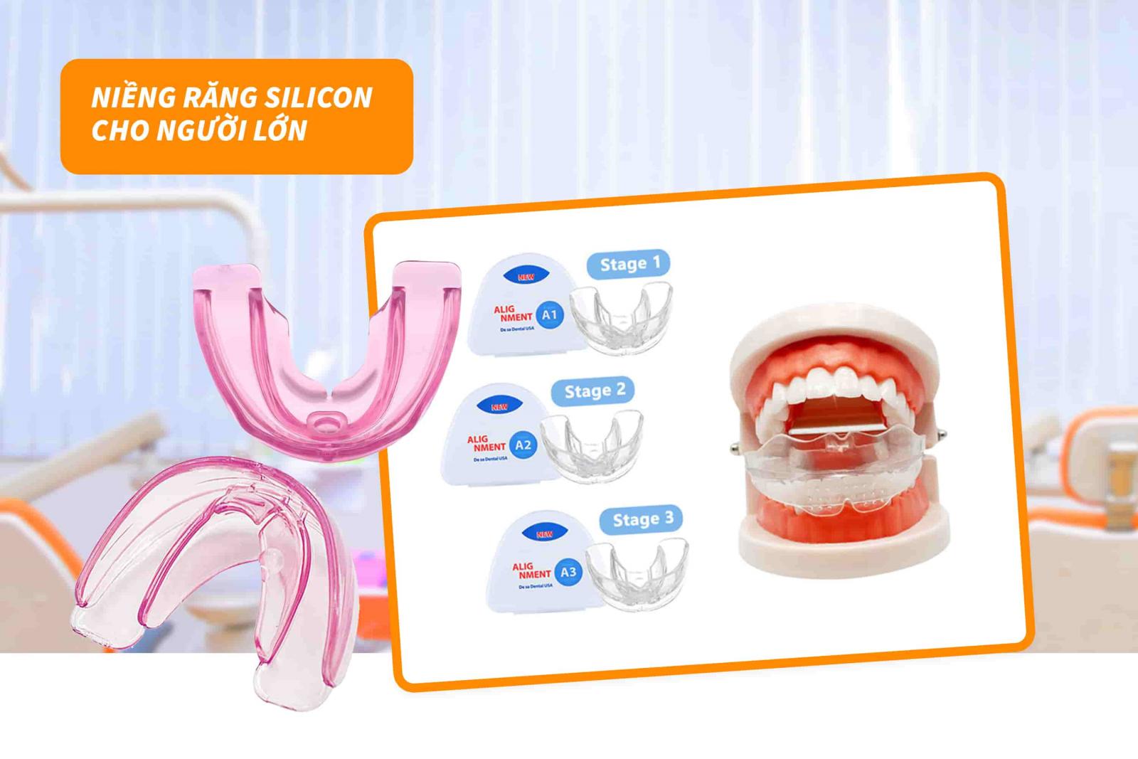 Niềng răng silicon cho người lớn