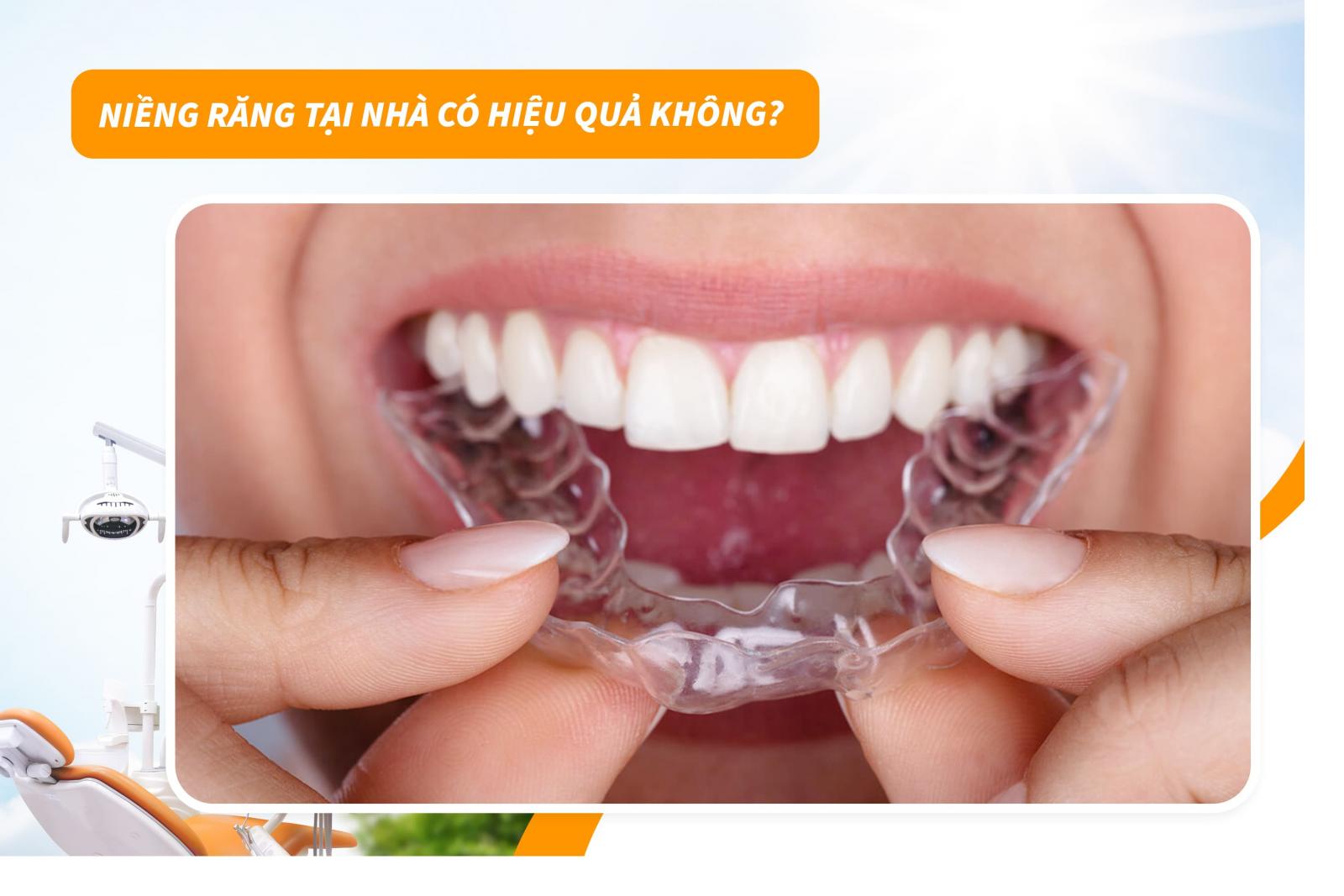 Niềng răng tại nhà có hiệu quả không?