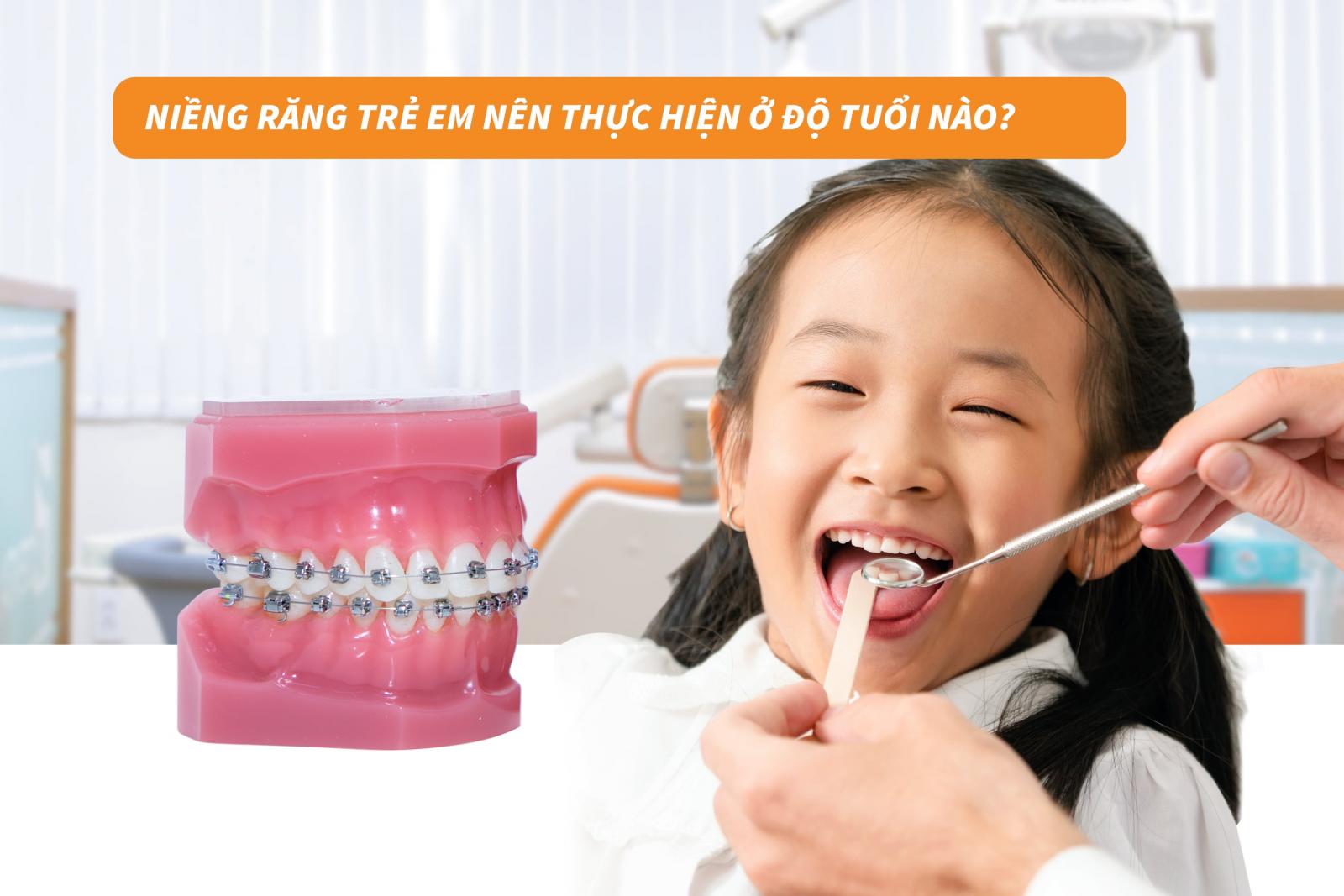 Niềng răng trẻ em nên thực hiện ở độ tuổi nào?