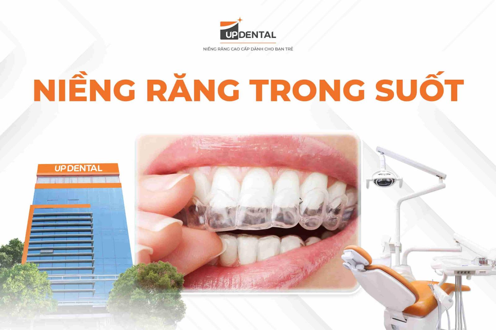 Niềng răng trong suốt 