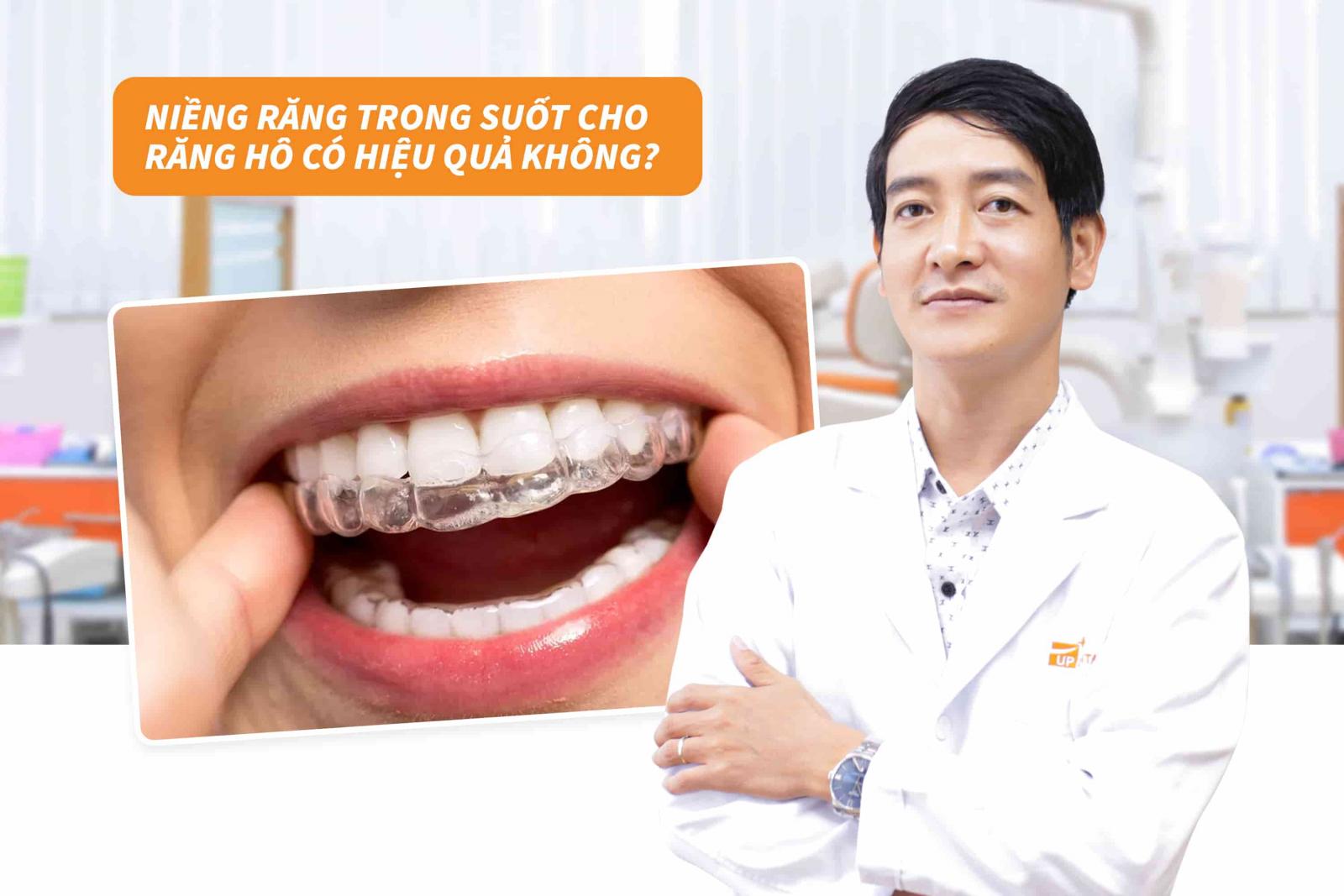 Niềng răng trong suốt cho răng hô có hiệu quả không?
