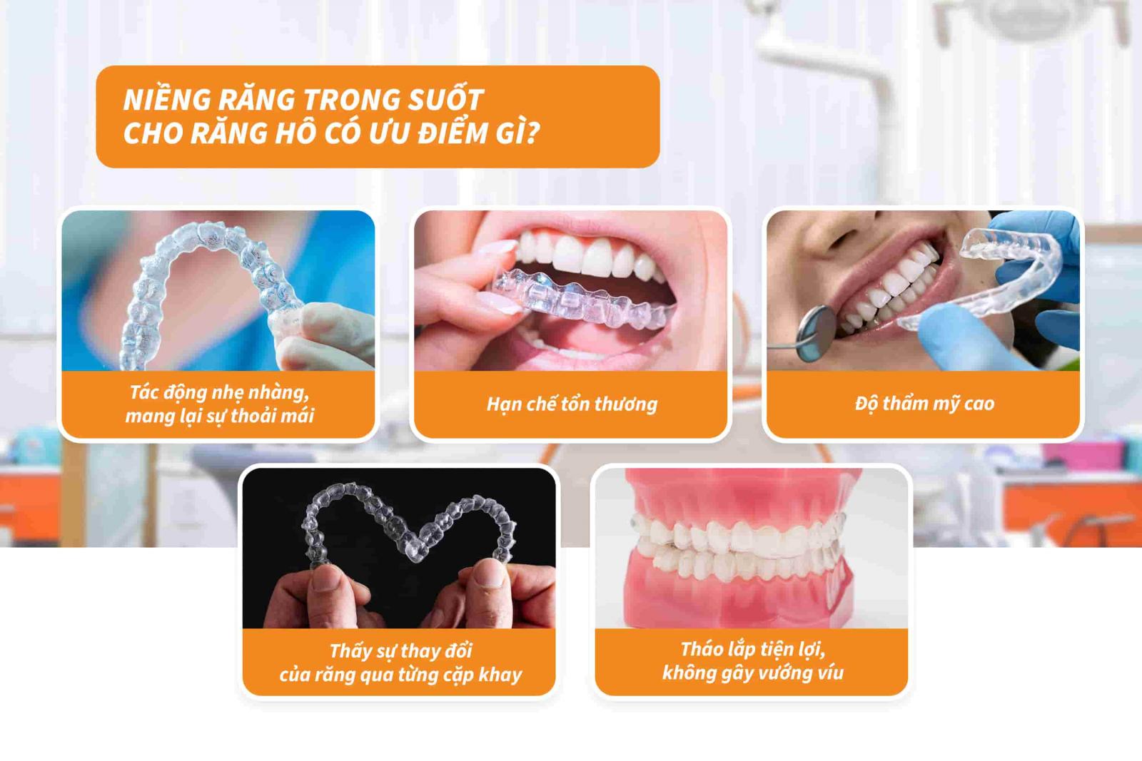 Niềng răng trong suốt cho răng hô có ưu điểm gì?