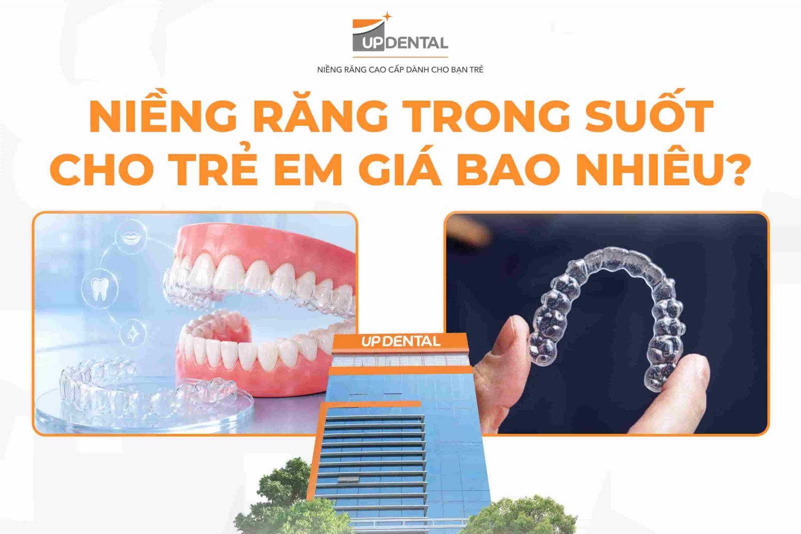 Niềng răng trong suốt cho trẻ em giá bao nhiêu?