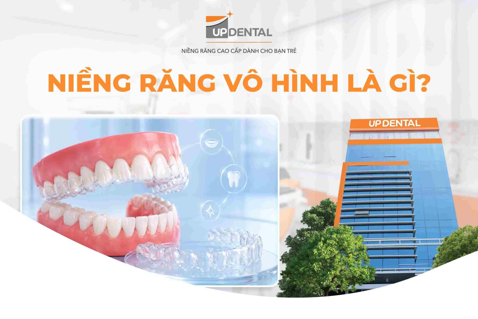 Niềng răng vô hình là gì?