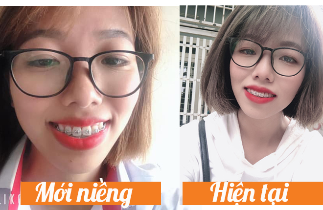 hàm duy trì