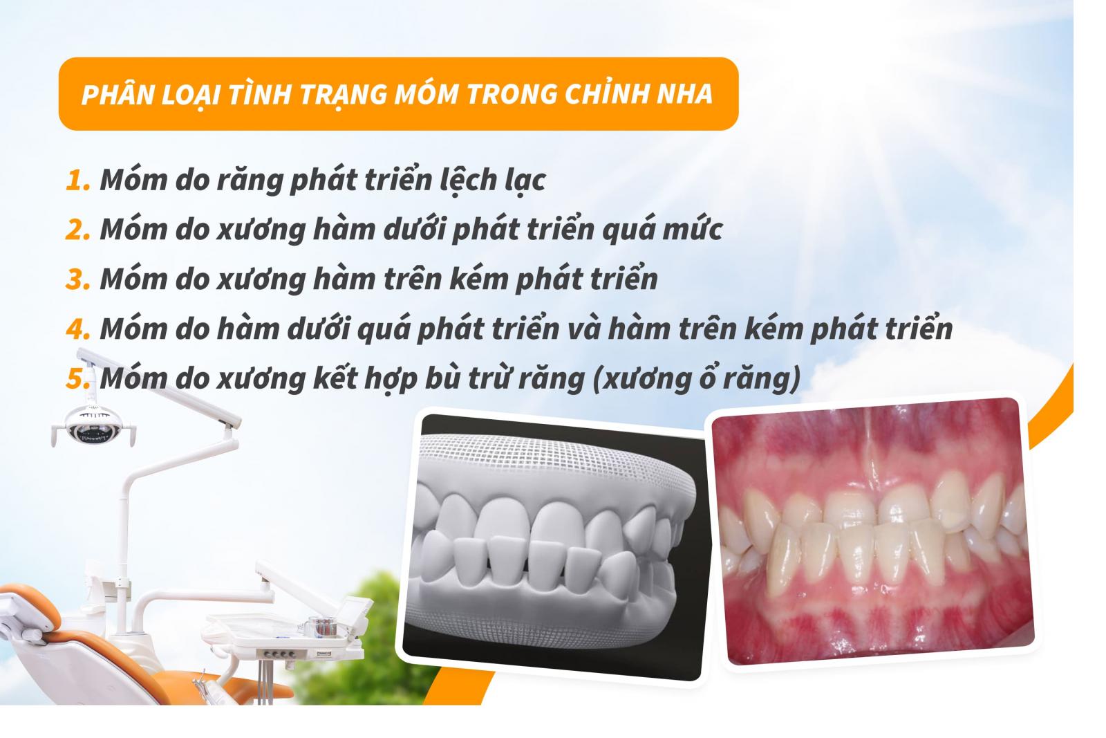 Phân loại tình trạng móm trong chỉnh nha