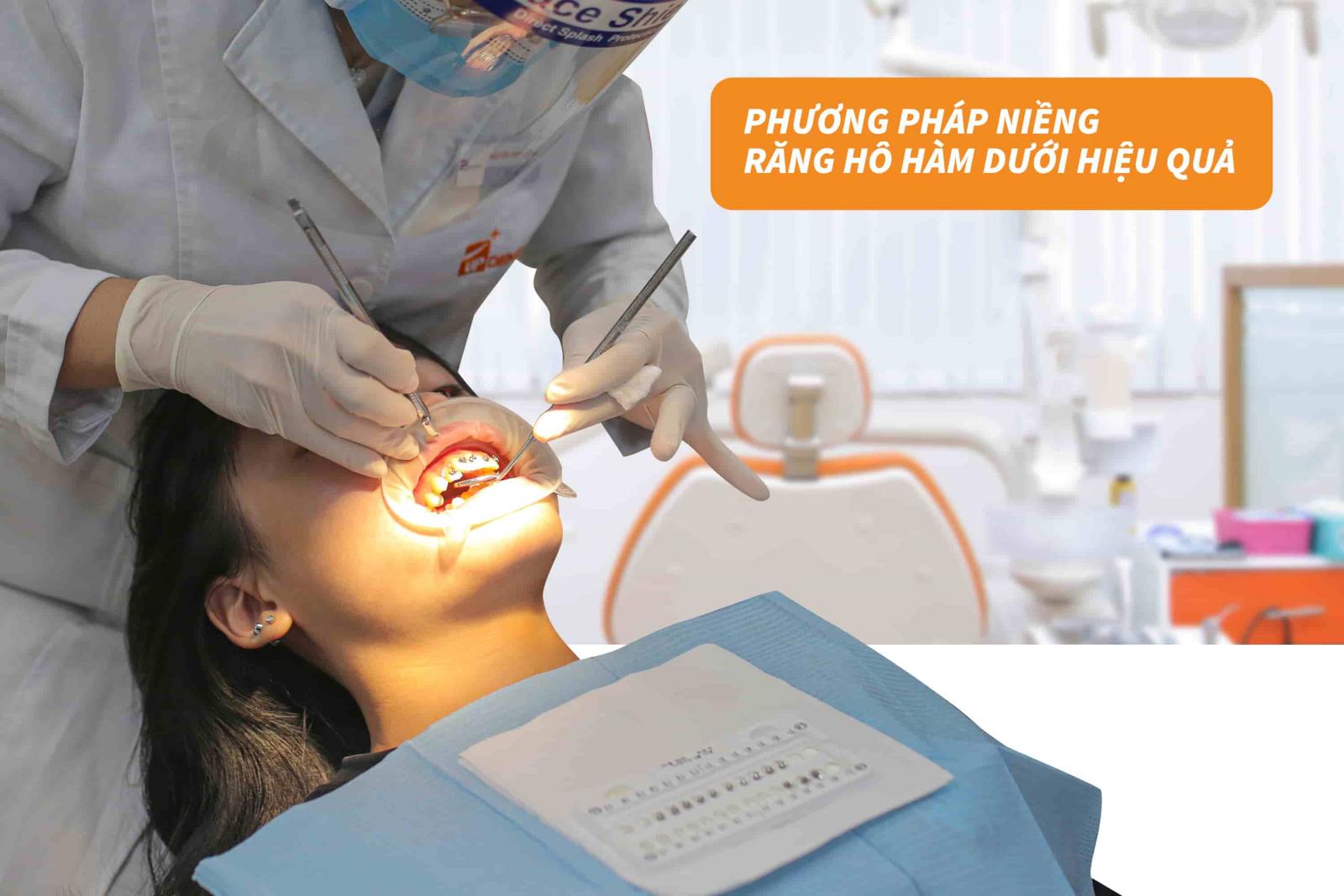 Phương pháp niềng răng hô hàm dưới hiệu quả