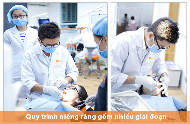 quy trinh nieng rang mac cai kim loai