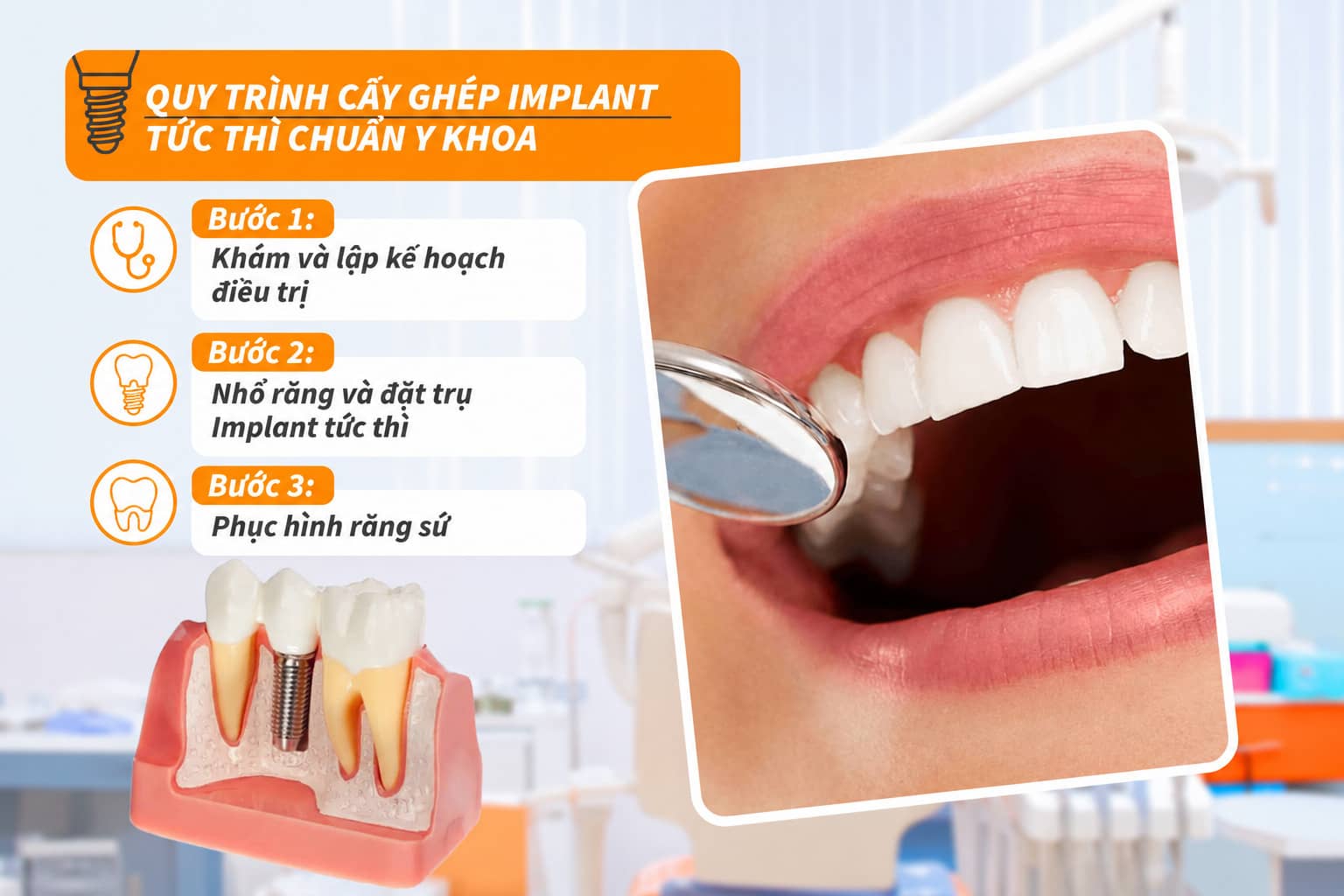 Quy trình cấy ghép Implant tức thì chuẩn Y khoa