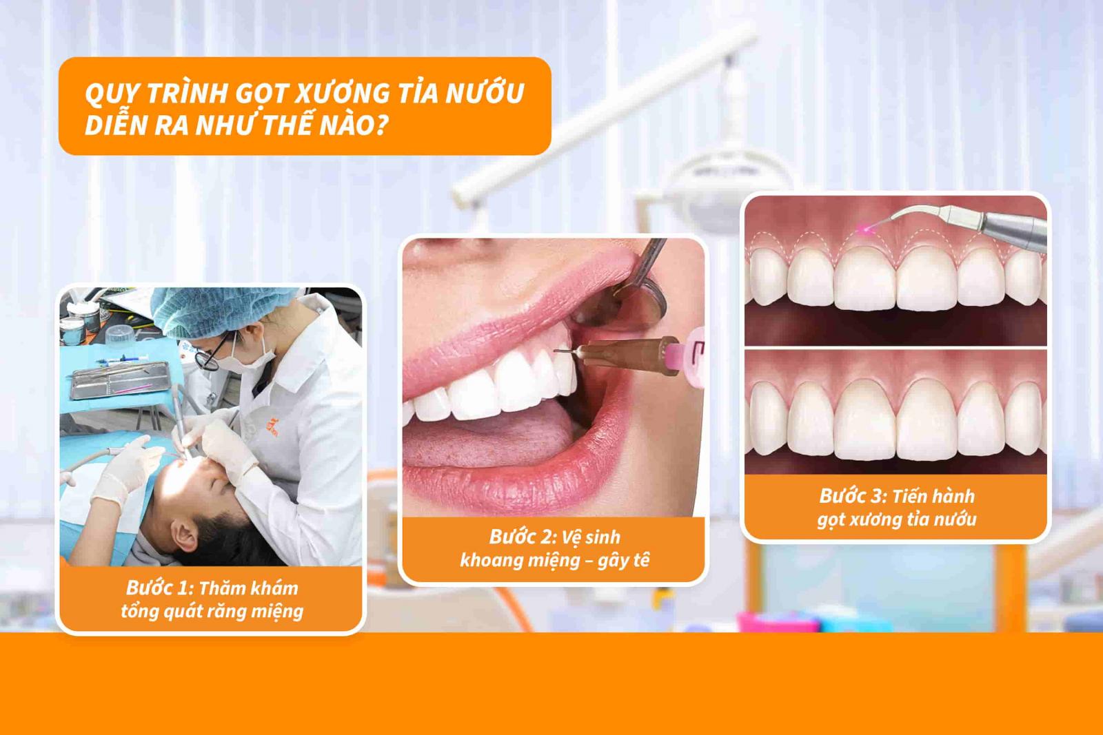 Quy trình gọt xương tỉa nướu diễn ra như thế nào?