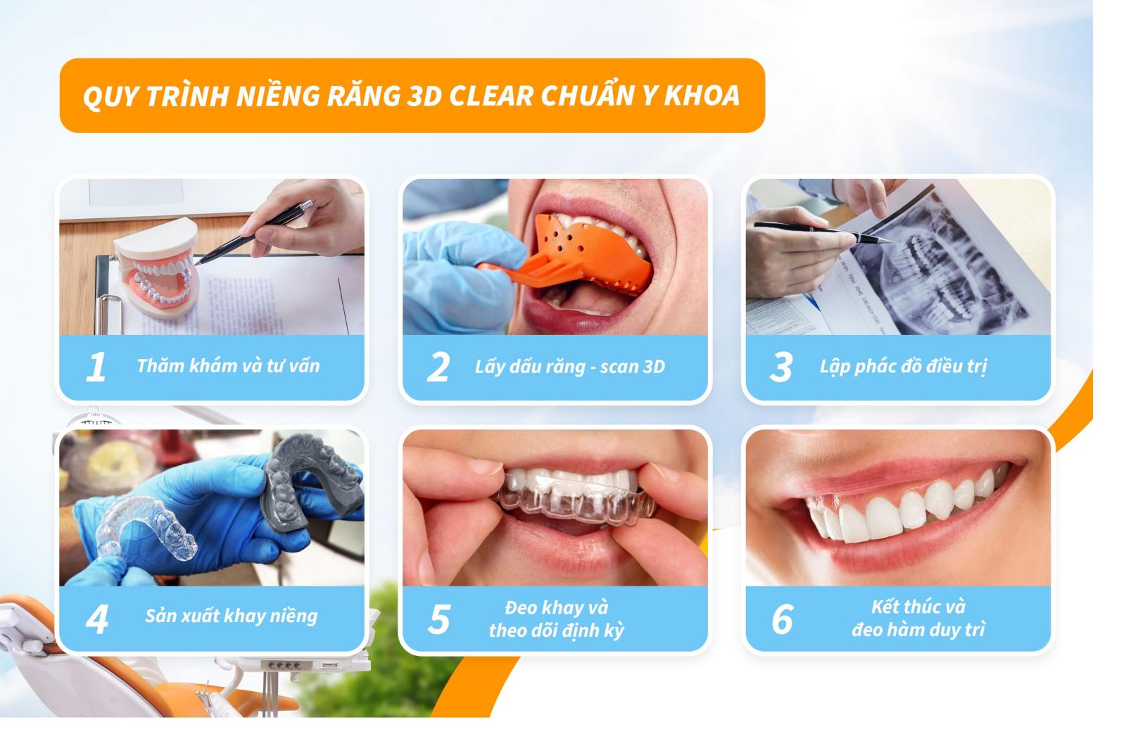 Quy trình niềng răng 3D Clear chuẩn Y Khoa