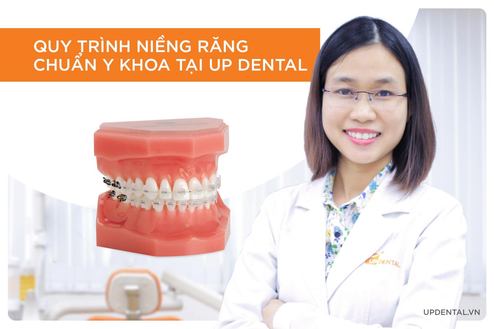 quy trình niềng răng chuẩn y khoa tại Up Dental