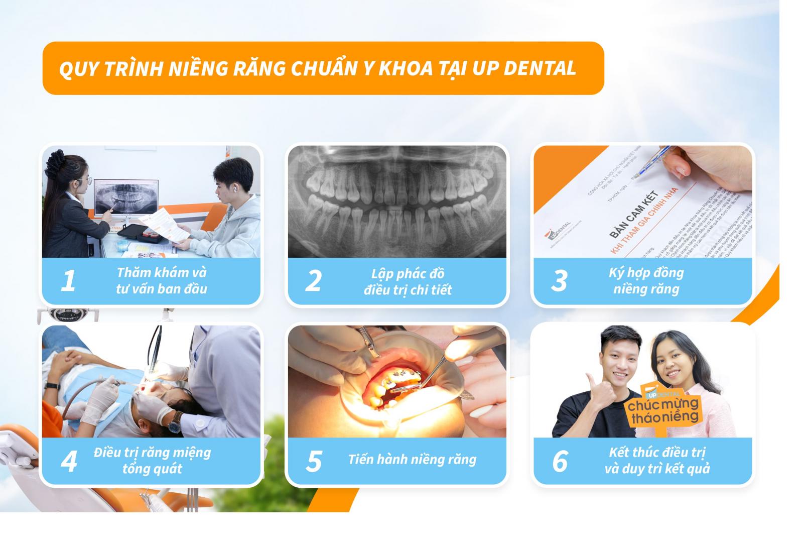 Quy trình niềng răng chuẩn Y khoa tại Up Dental