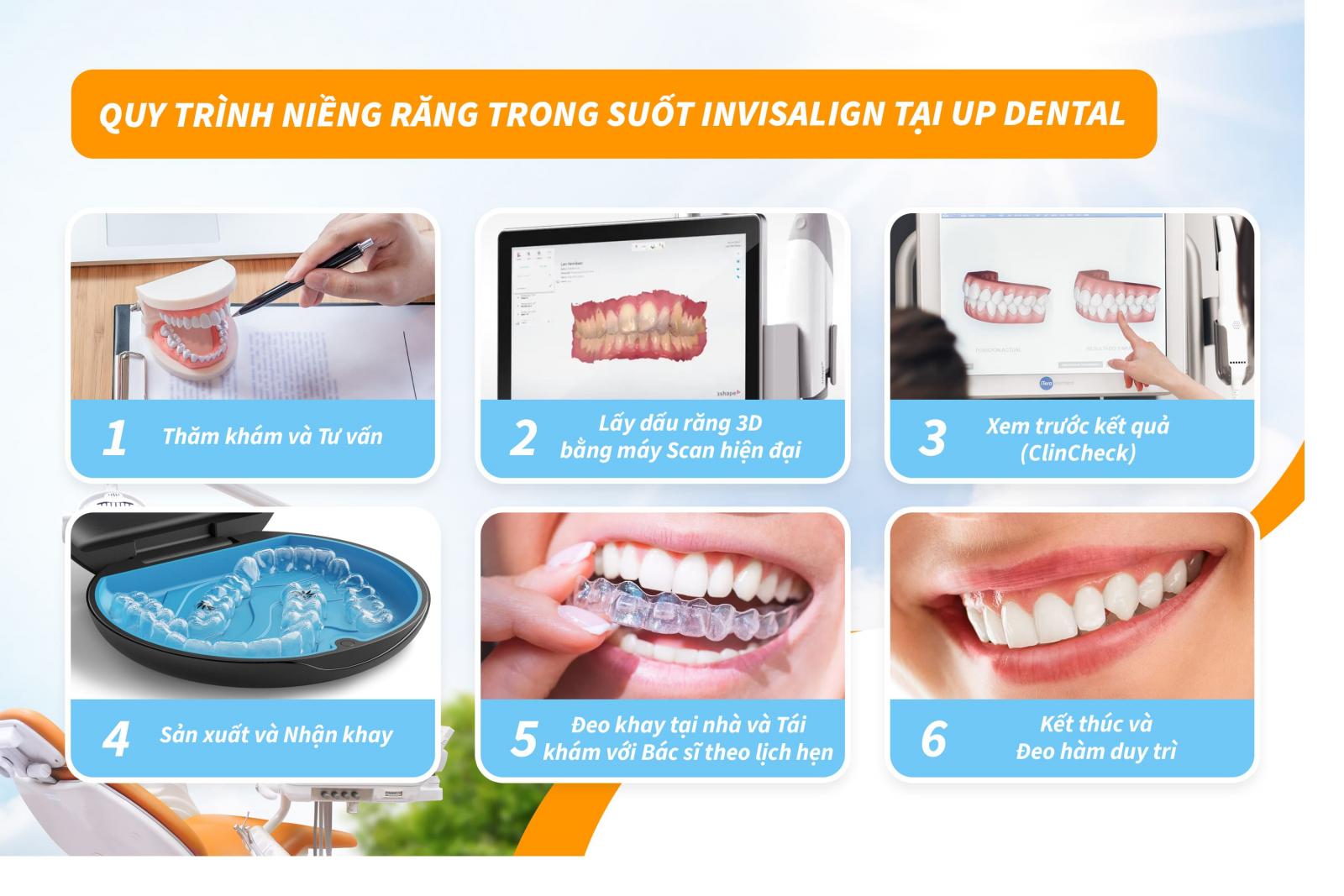 Quy trình niềng răng trong suốt Invisalign tại Up Dental