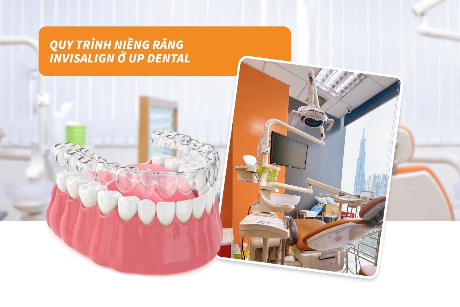 Quy trình niềng răng Invisalign ở Up Dental: