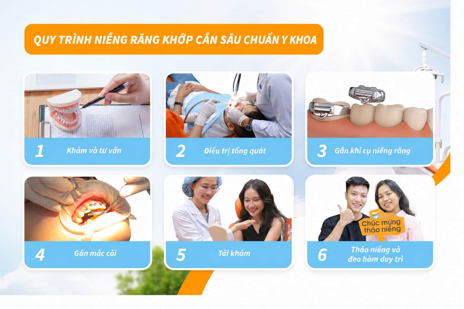 Quy trình niềng răng khớp cắn sâu chuẩn y khoa