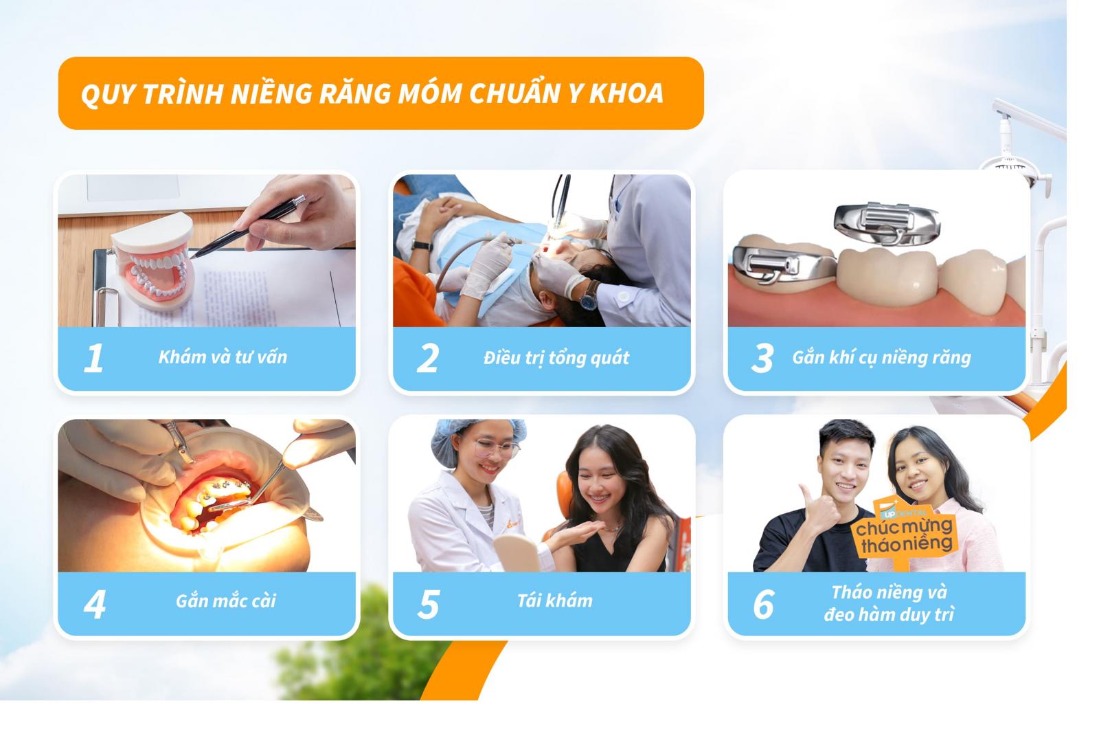 Quy trình niềng răng móm chuẩn Y khoa tại Up Dental