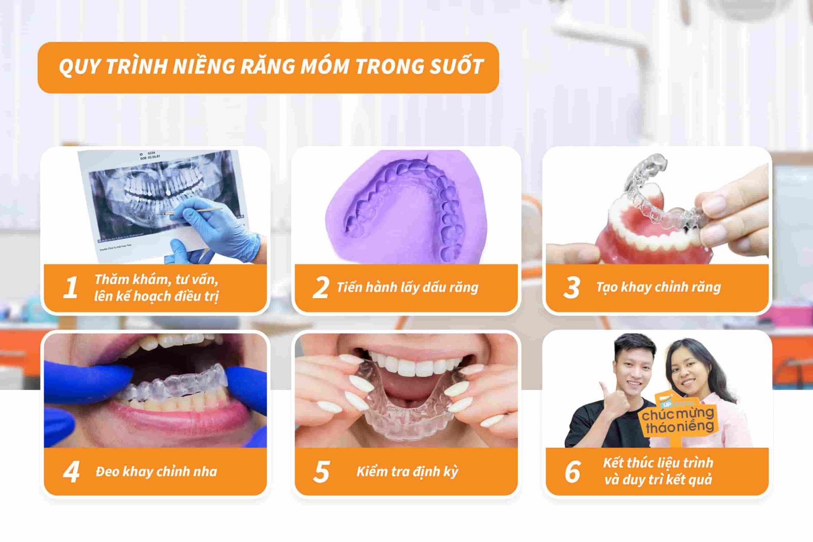 Quy trình niềng răng móm trong suốt