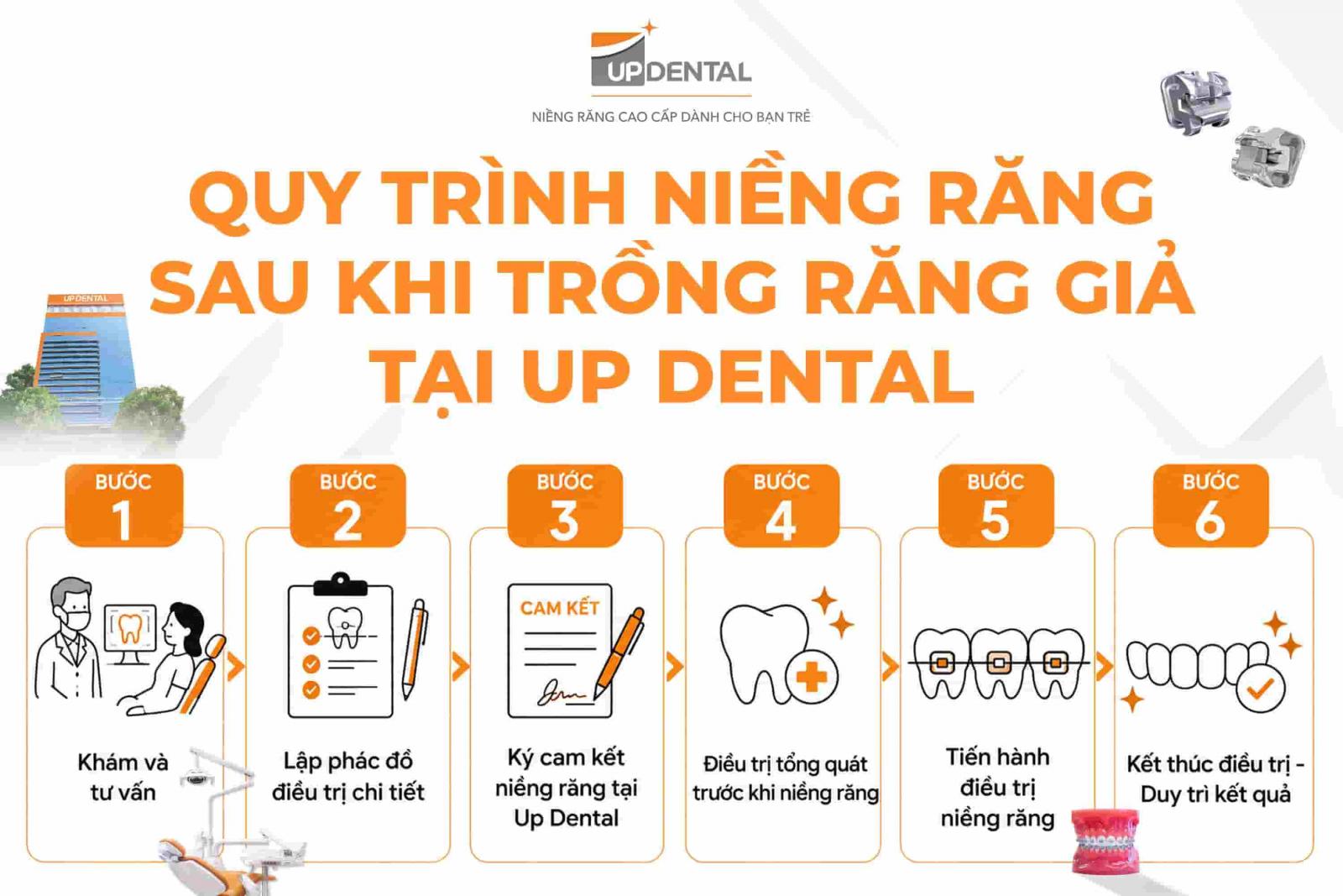 Quy trình niềng răng sau khi trồng răng giả tại Up Dental