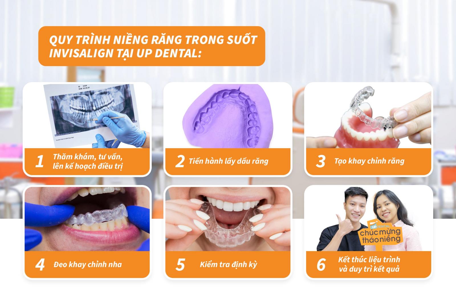 Quy trình niềng răng Invisalign