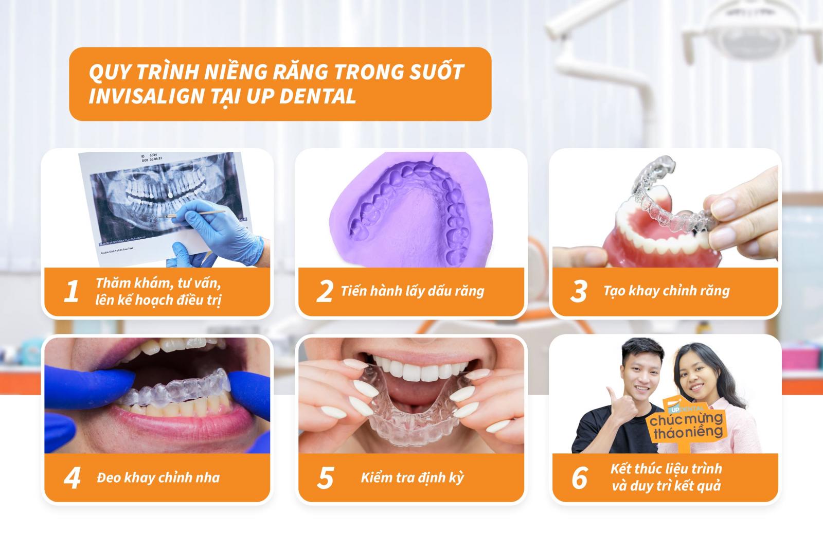 Quy trình niềng răng trong suốt Invisalign tại Up Dental