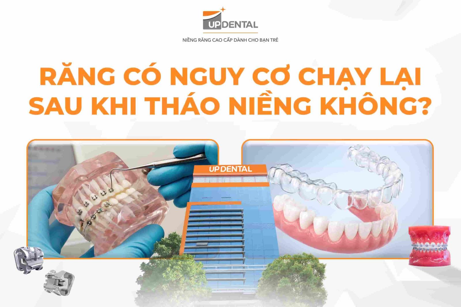 Răng có nguy cơ chạy lại sau khi tháo niềng không?