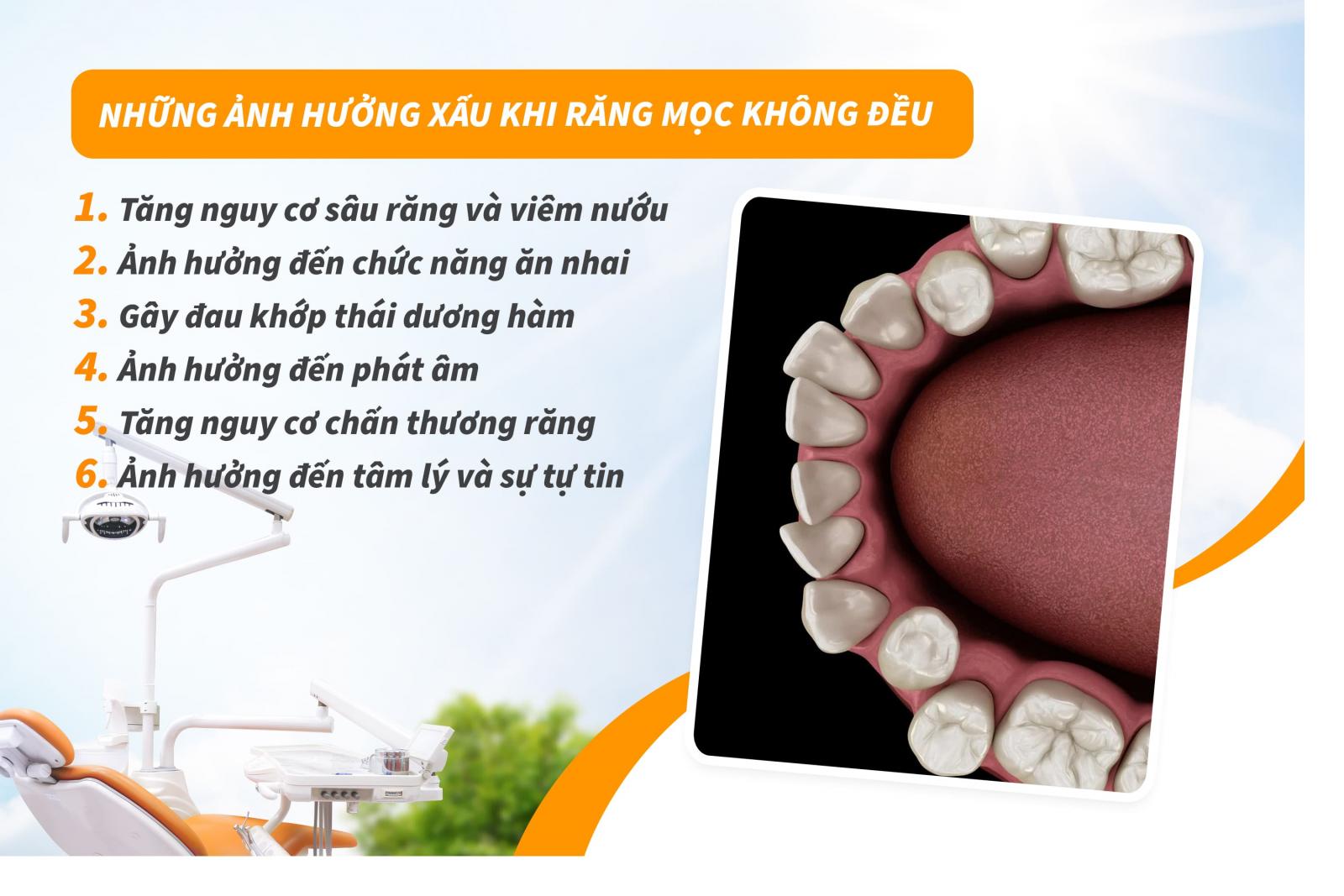 Răng mọc không đều ảnh hưởng gì?