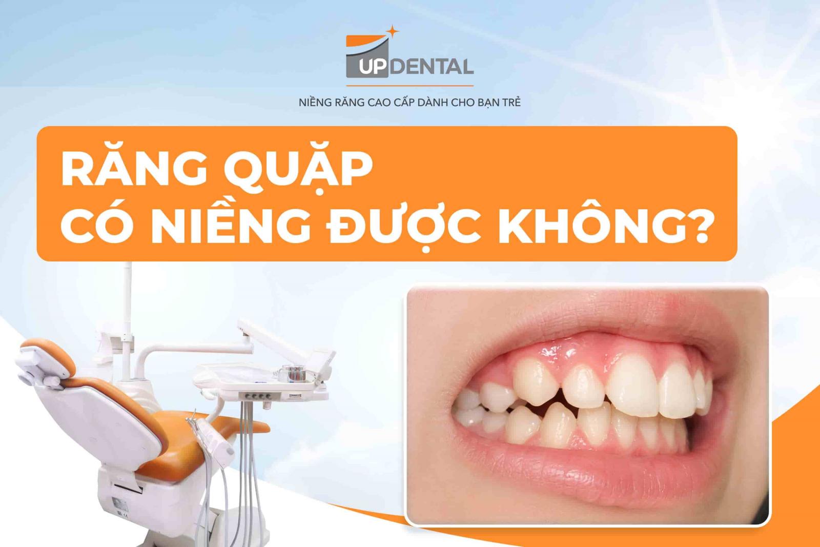 Răng quặp có niềng được không? 