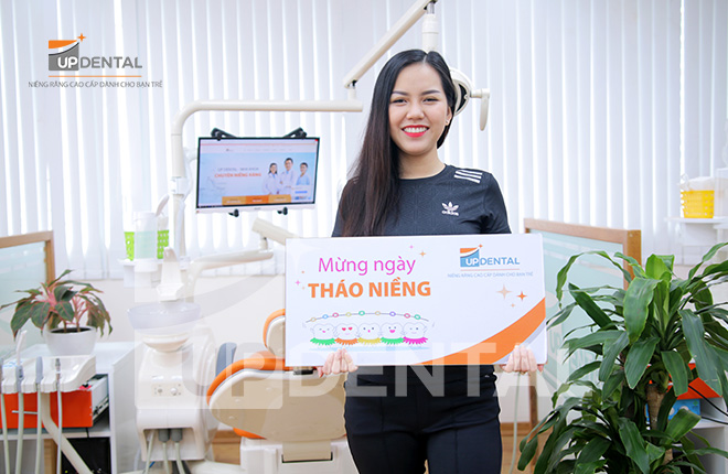 Review niềng răng sứ