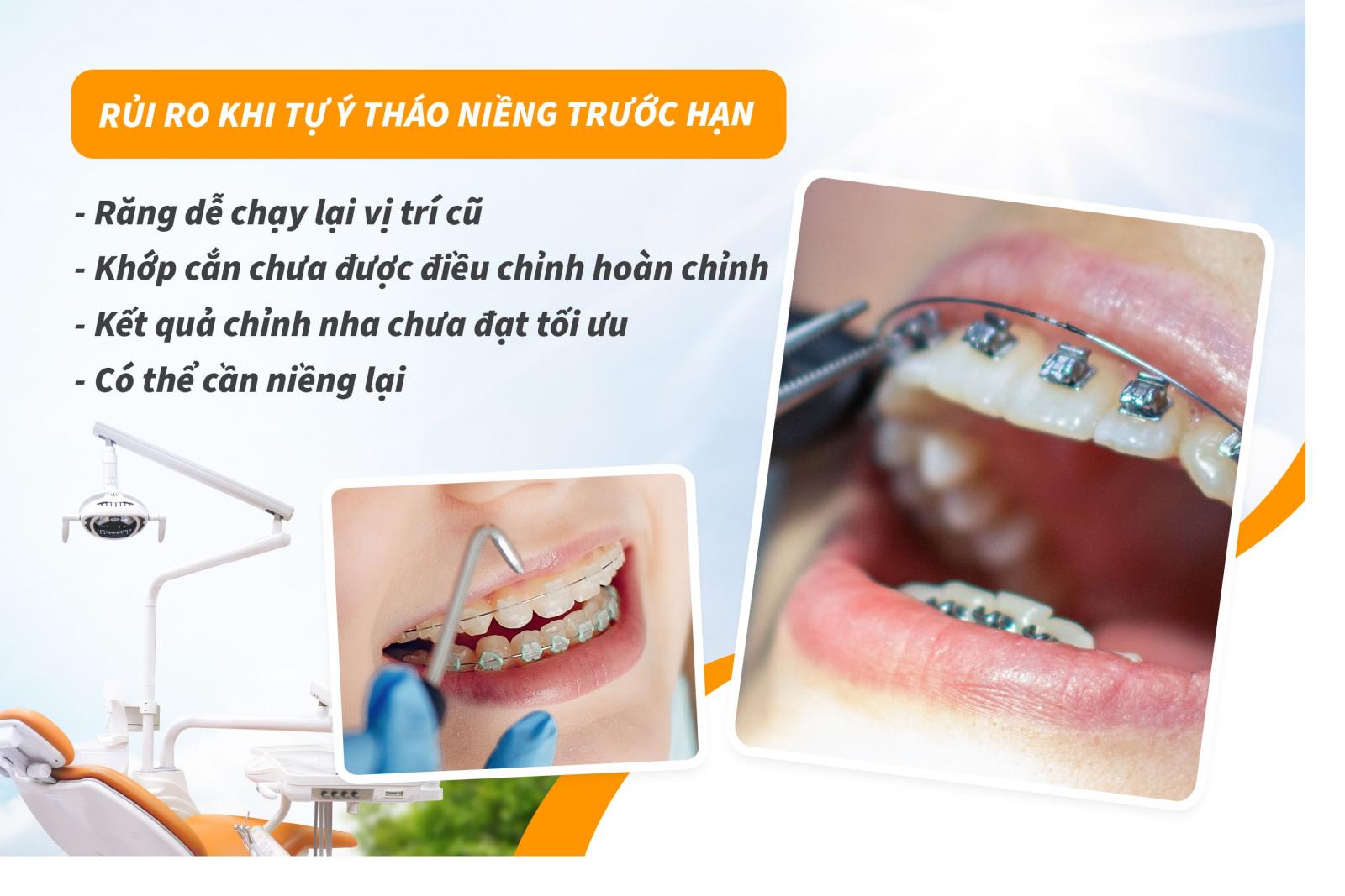 Rủi ro khi tự ý tháo niềng trước hạn