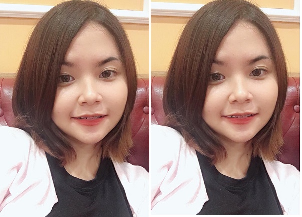 hinh anh rang sau khi nieng