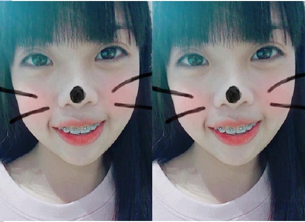 Hinh anh sau khi nieng rang
