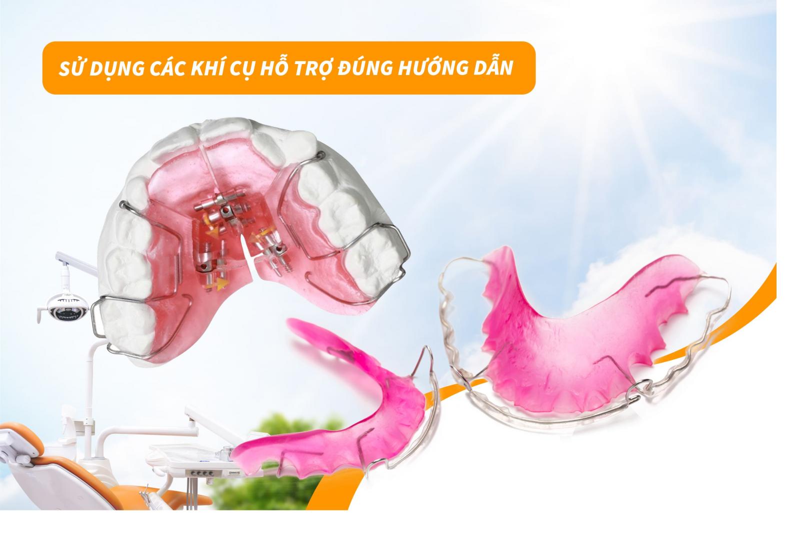 Sử dụng các khí cụ hỗ trợ đúng hướng dẫn