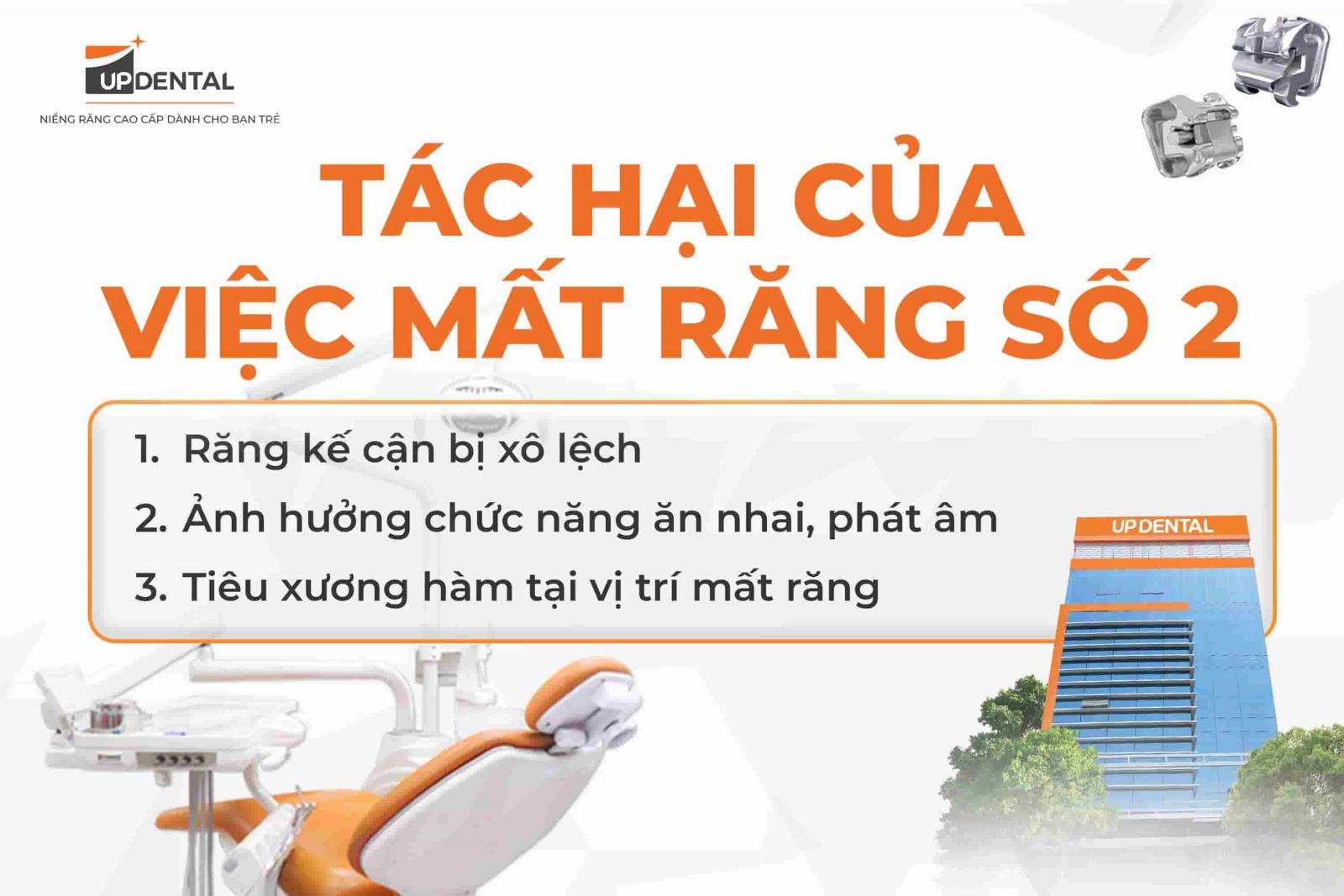 Tác hại của việc mất răng số 2