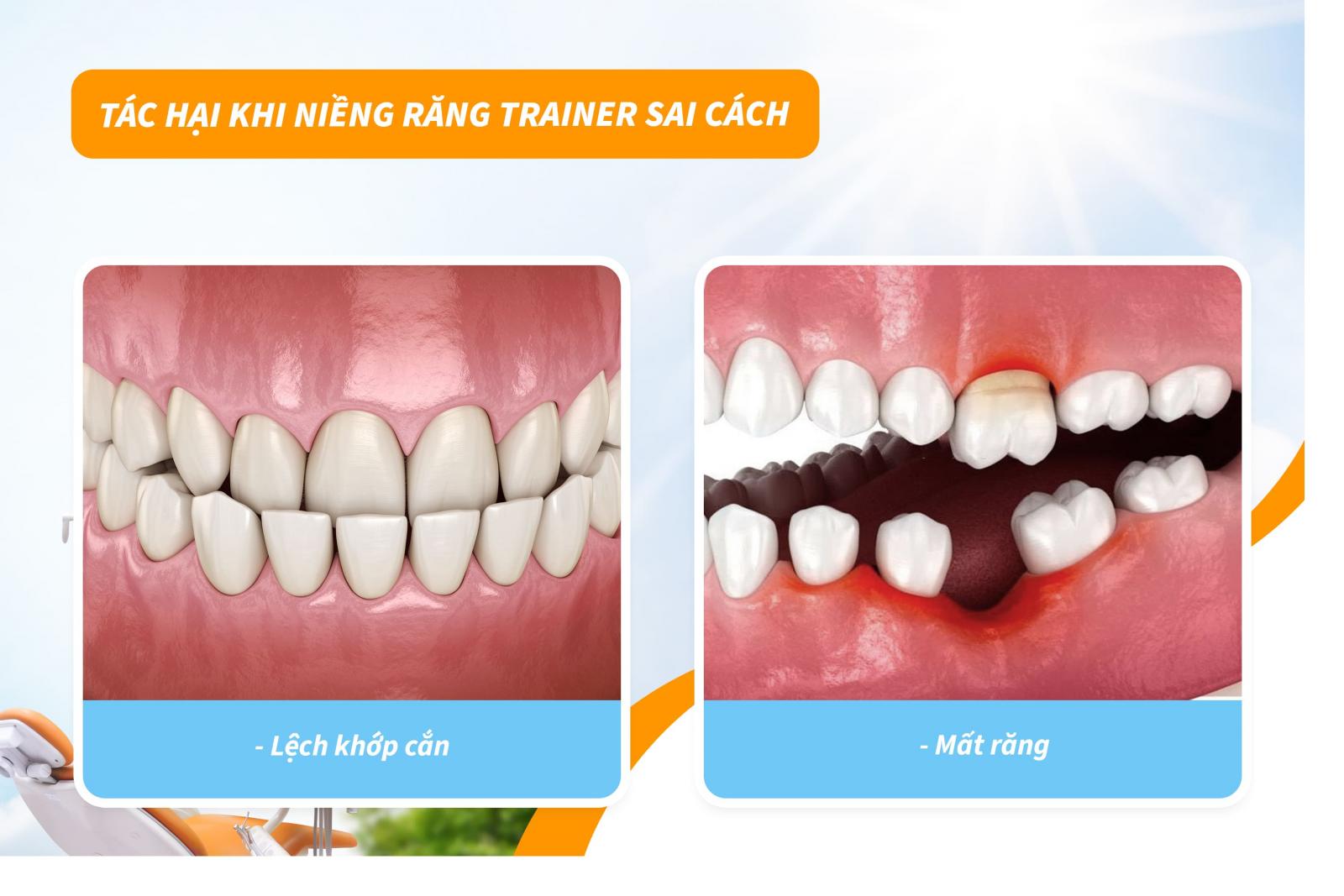 Tác hại khi niềng răng trainer sai cách