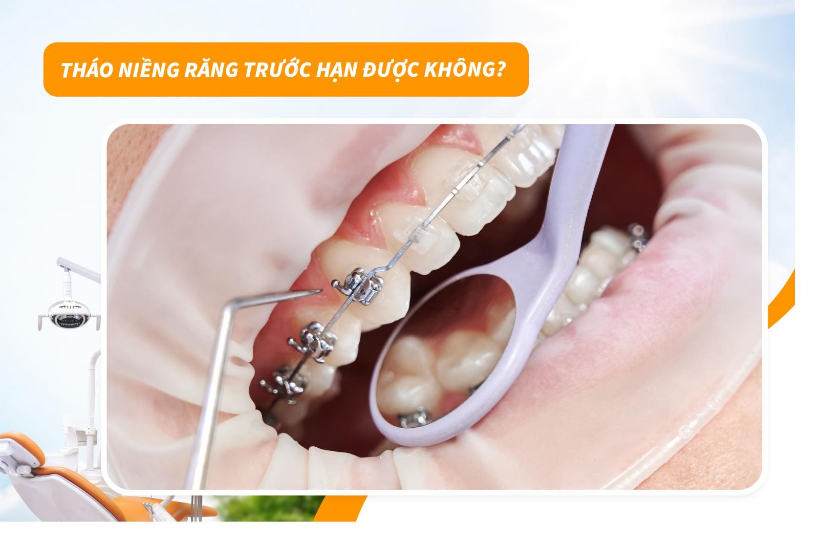 Tháo niềng răng trước hạn được không?