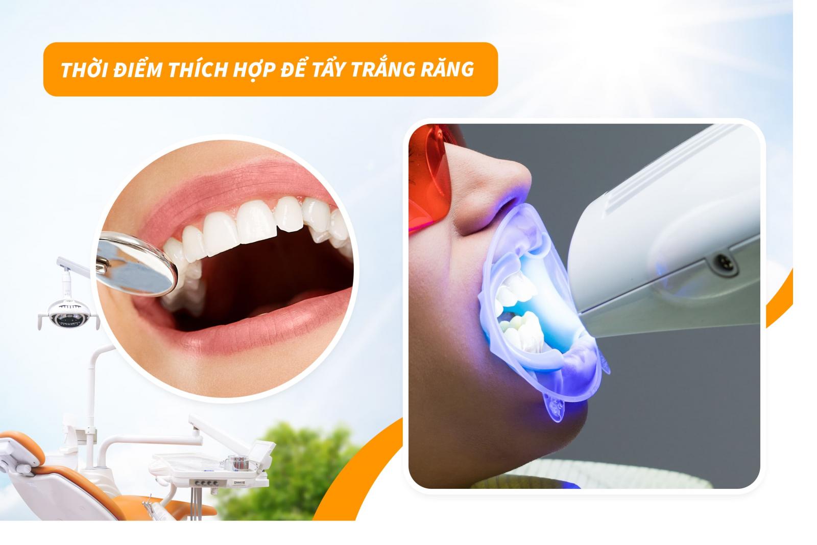 Thời điểm thích hợp để tẩy trắng răng