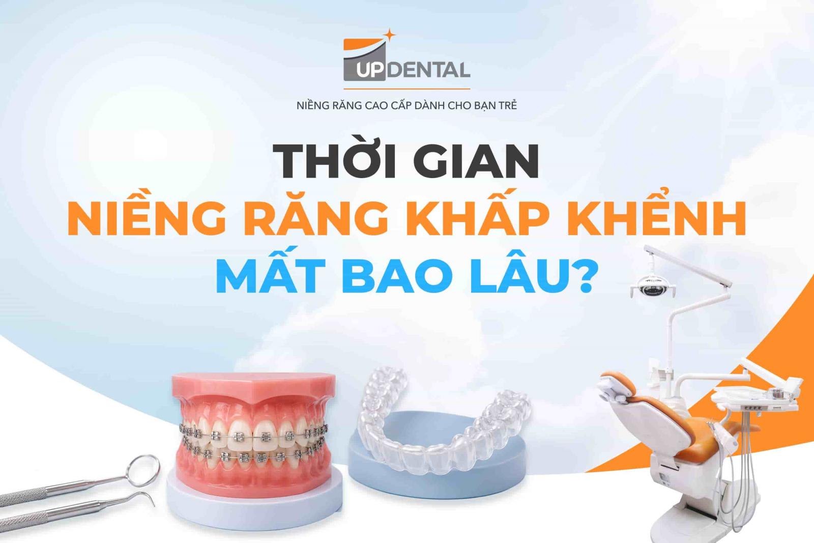 Thời gian niềng răng khấp khểnh mất bao lâu?