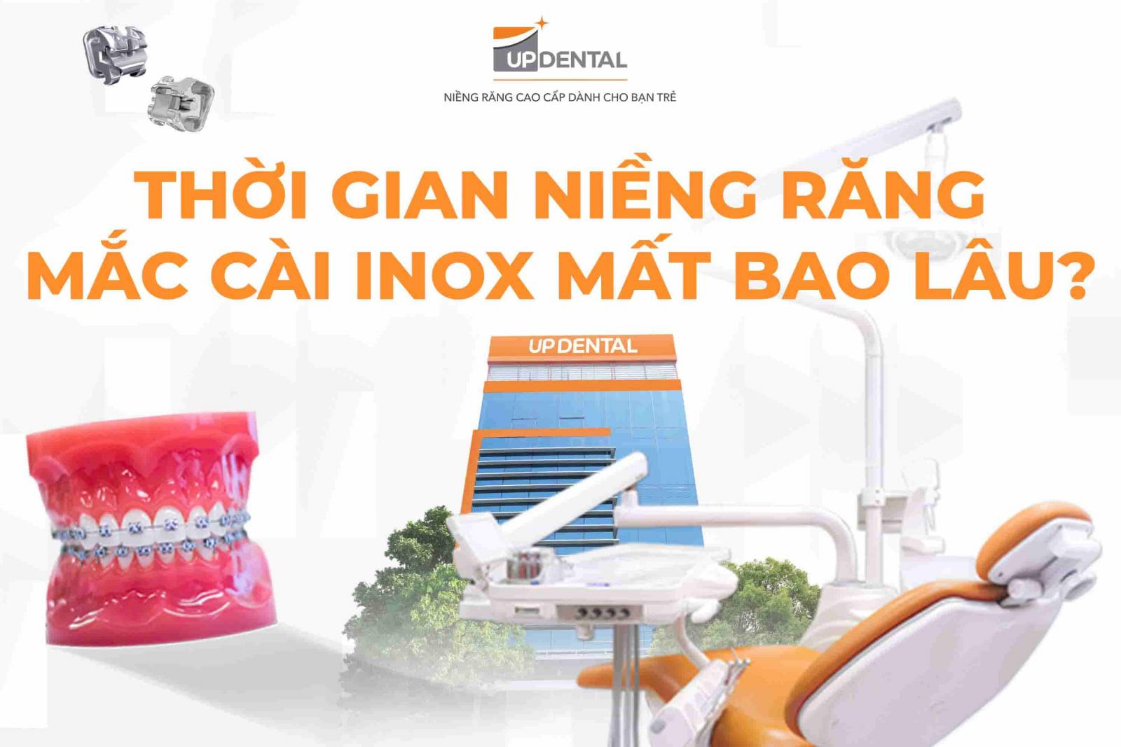 Thời gian niềng răng mắc cài inox mất bao lâu?