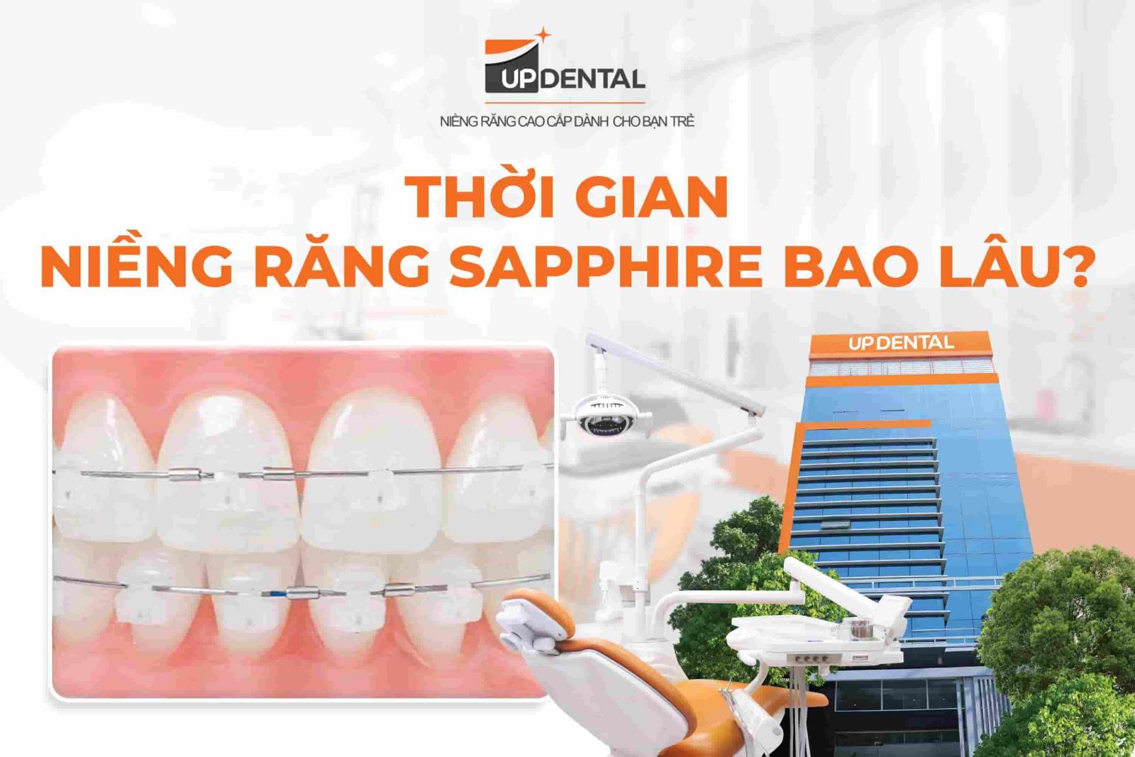 Thời gian niềng răng sapphire bao lâu?