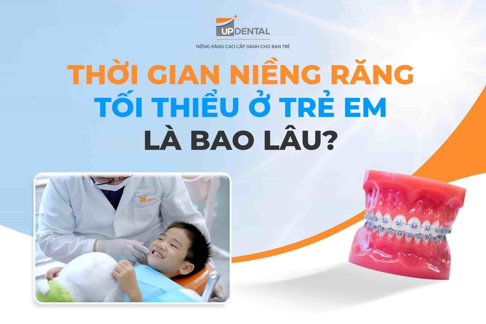 Thời gian niềng răng tối thiểu ở trẻ em là bao lâu?