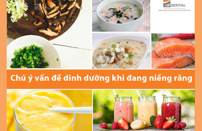 thuc don cho nguoi nieng rang