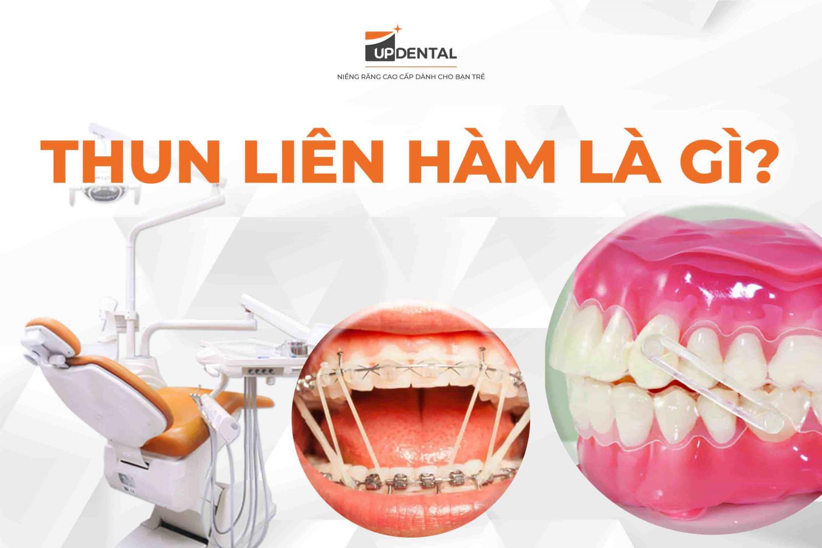 Thun liên hàm là gì?