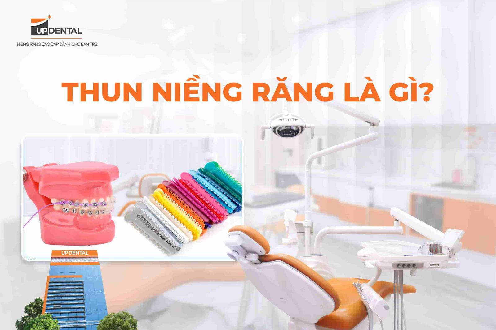 Thun niềng răng là gì?