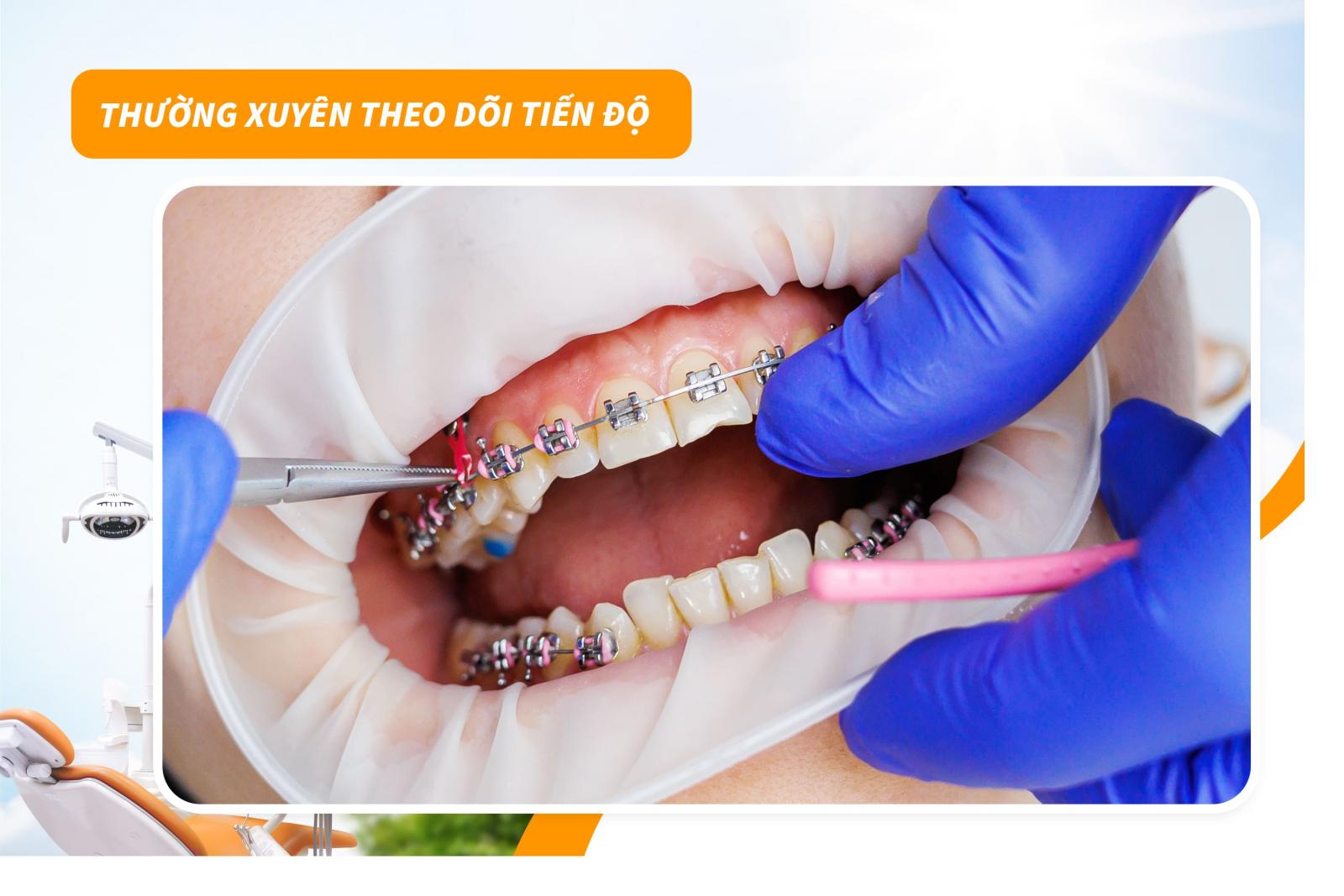 Thường xuyên theo dõi tiến độ