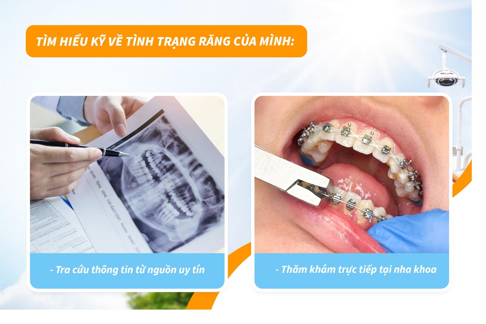 Tìm hiểu kỹ về tình trạng răng của mình