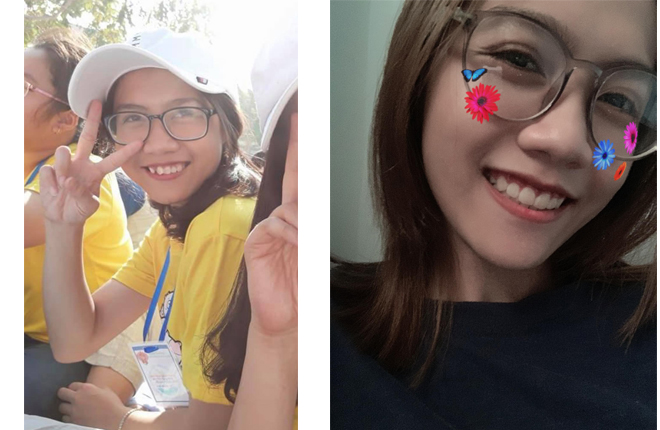 niềng răng up dental