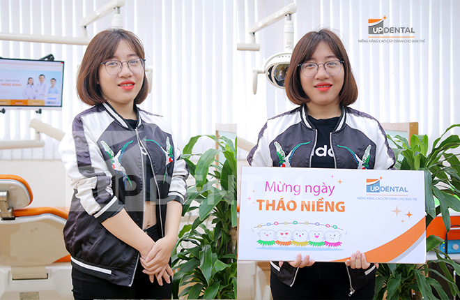 Review niềng răng Up Dental