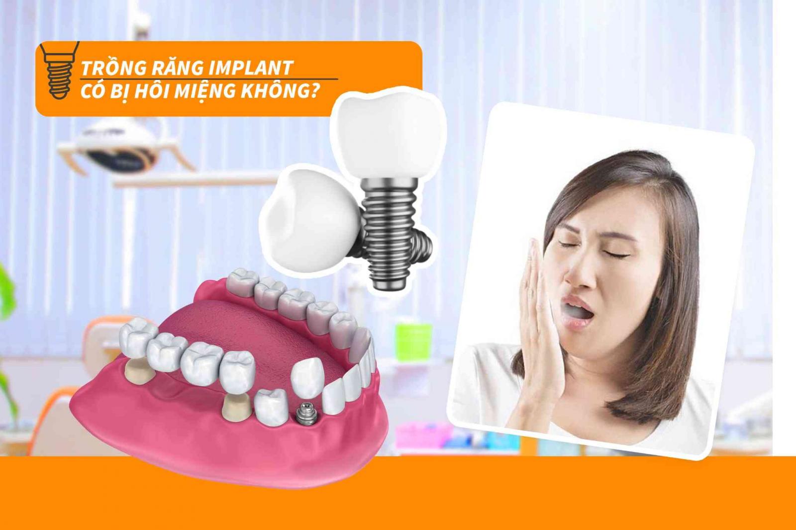 Trồng răng Implant có bị hôi miệng không?